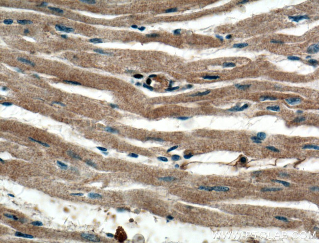 MYPT1 Antibody in Immunohistochemistry (Paraffin) (IHC (P))