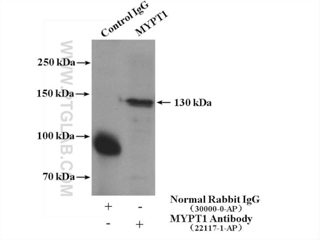 MYPT1 Antibody in Immunoprecipitation (IP)