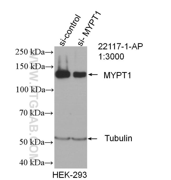 MYPT1 Antibody in Western Blot (WB)