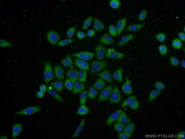 Ubiquilin 1 Antibody in Immunocytochemistry (ICC/IF)