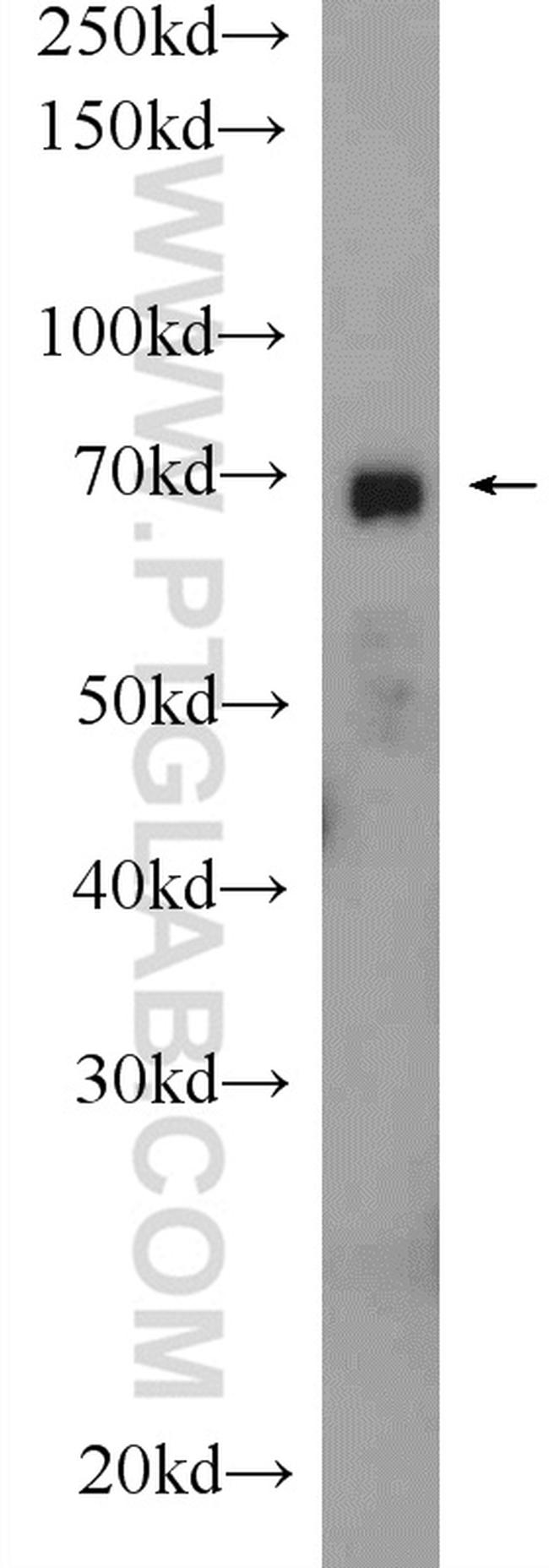 Ubiquilin 1 Antibody in Western Blot (WB)