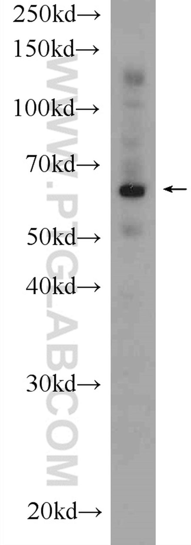 Ubiquilin 1 Antibody in Western Blot (WB)