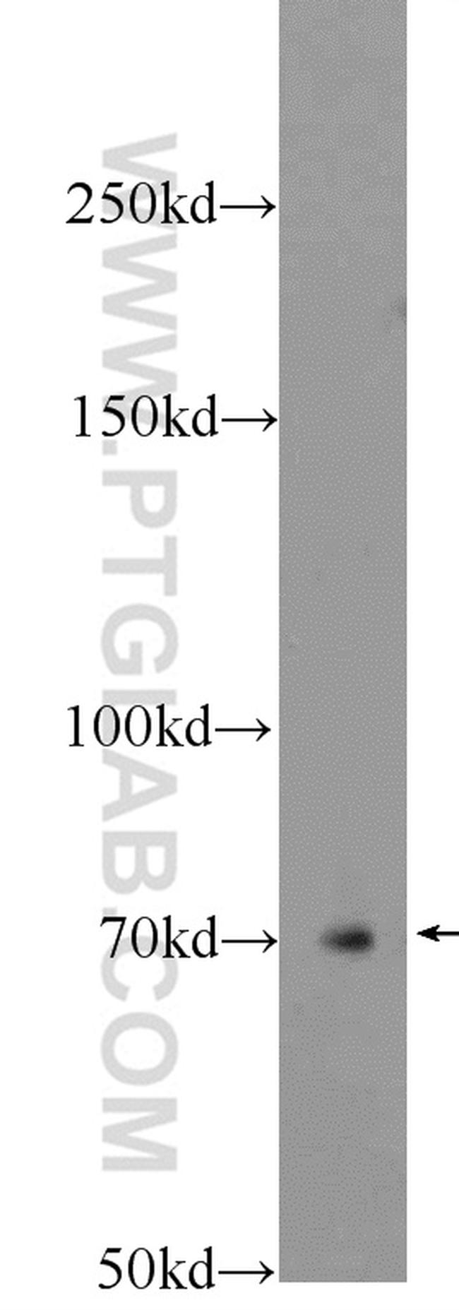 Ubiquilin 1 Antibody in Western Blot (WB)