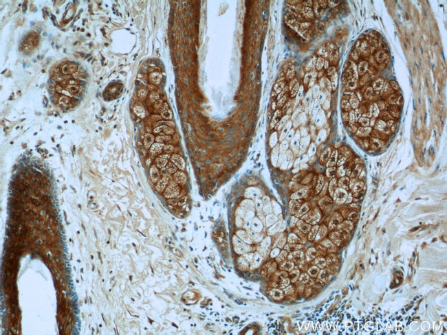 ARAF Antibody in Immunohistochemistry (Paraffin) (IHC (P))