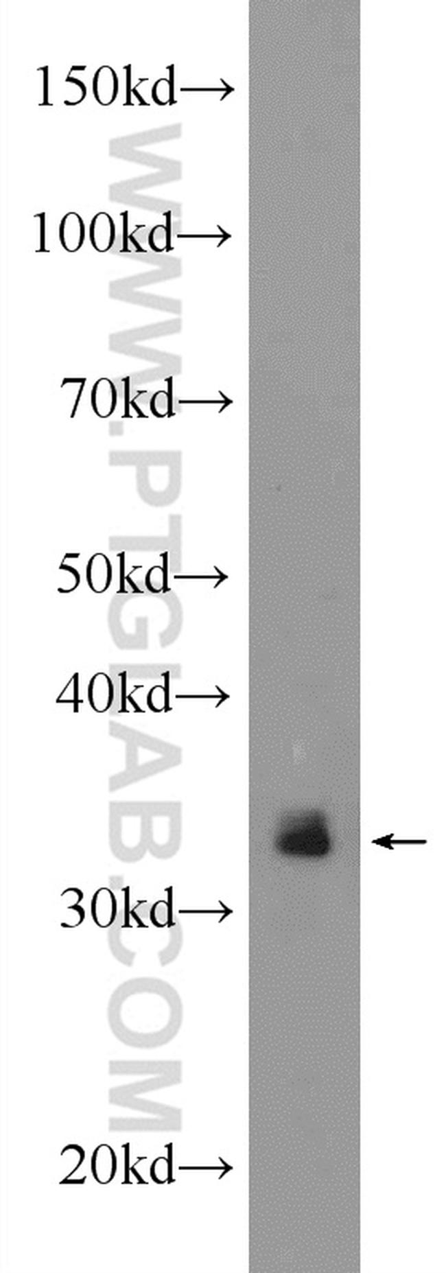 ARAF Antibody in Western Blot (WB)