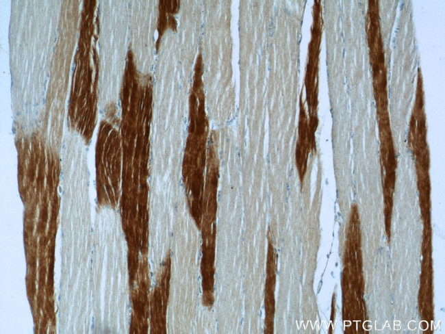 TNNI2 Antibody in Immunohistochemistry (Paraffin) (IHC (P))