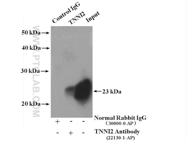 TNNI2 Antibody in Immunoprecipitation (IP)