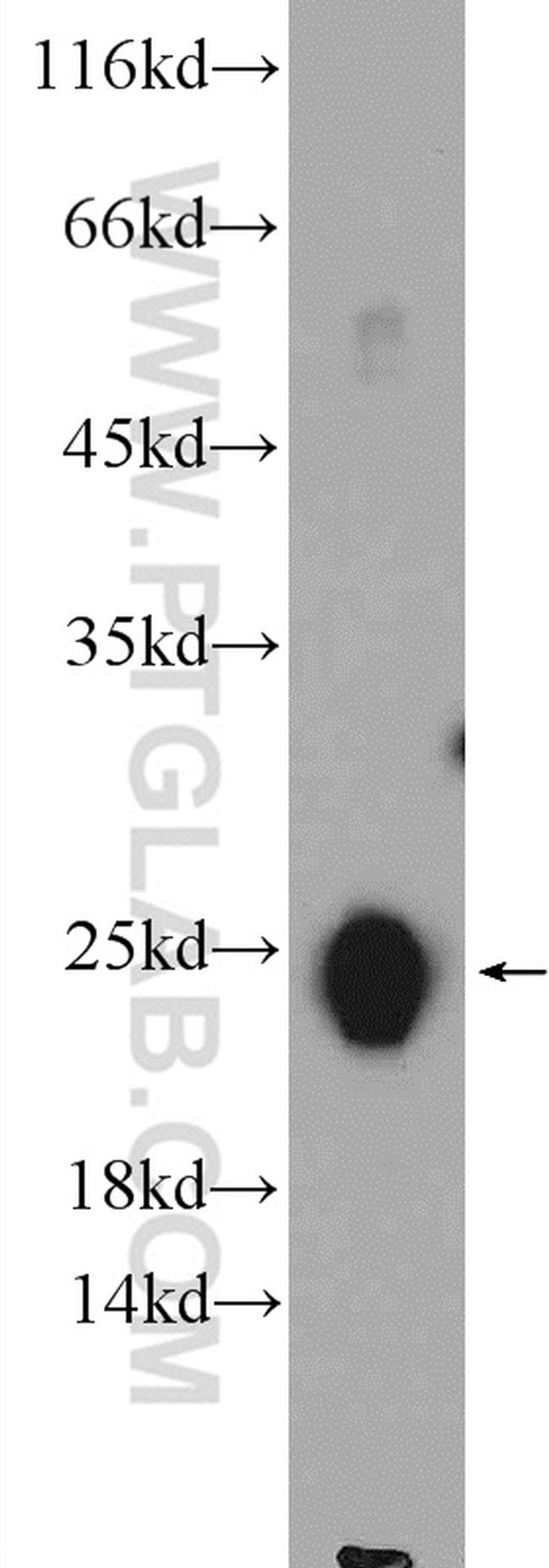 TNNI2 Antibody in Western Blot (WB)