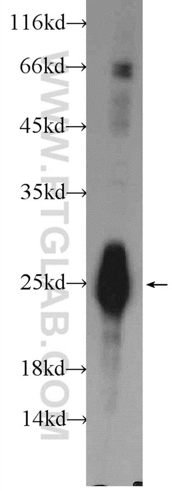 TNNI2 Antibody in Western Blot (WB)