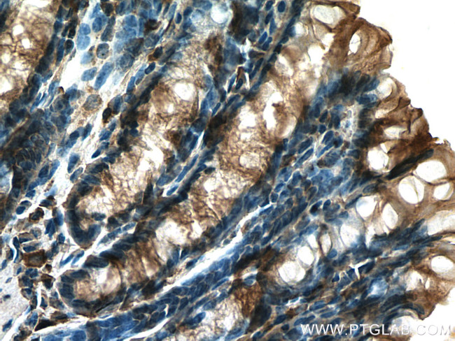 TIGAR Antibody in Immunohistochemistry (Paraffin) (IHC (P))