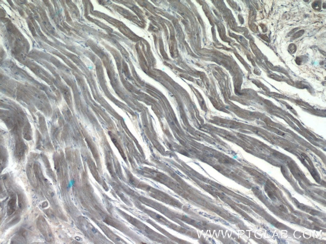 DAND5 Antibody in Immunohistochemistry (Paraffin) (IHC (P))