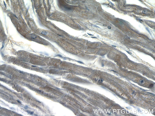 DAND5 Antibody in Immunohistochemistry (Paraffin) (IHC (P))