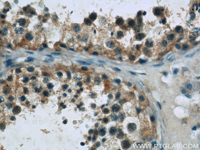 DAND5 Antibody in Immunohistochemistry (Paraffin) (IHC (P))