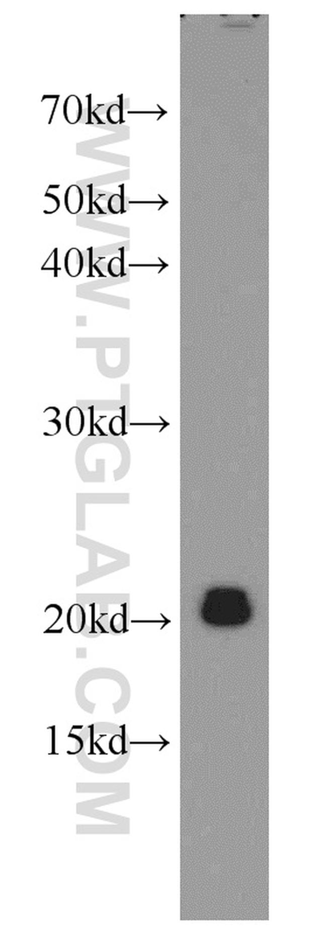 DAND5 Antibody in Western Blot (WB)