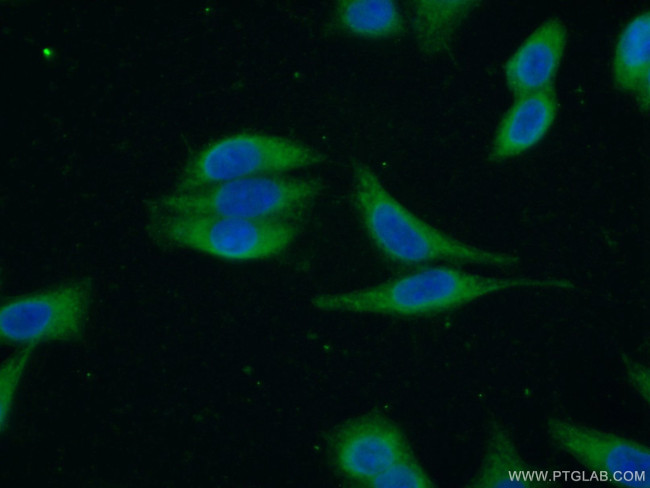 RASAL2 Antibody in Immunocytochemistry (ICC/IF)