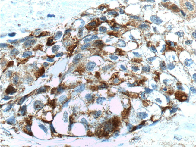 FUT4 Antibody in Immunohistochemistry (Paraffin) (IHC (P))