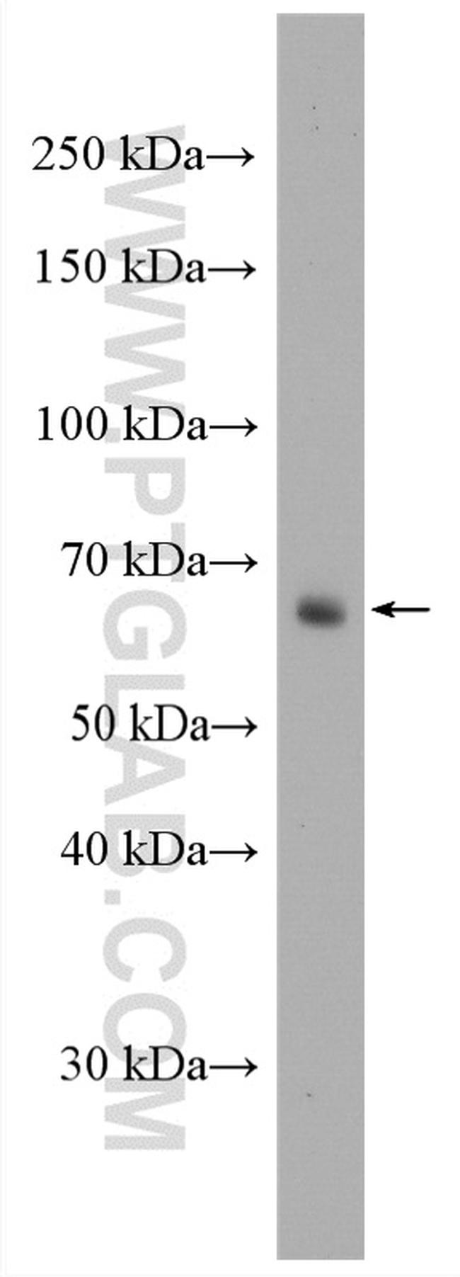 FUT4 Antibody in Western Blot (WB)