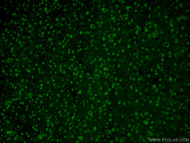 RCC1 Antibody in Immunohistochemistry (PFA fixed) (IHC (PFA))