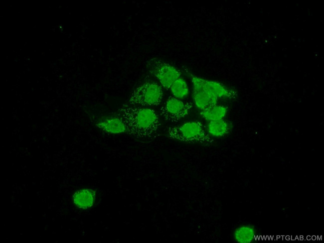 RCC1 Antibody in Immunocytochemistry (ICC/IF)