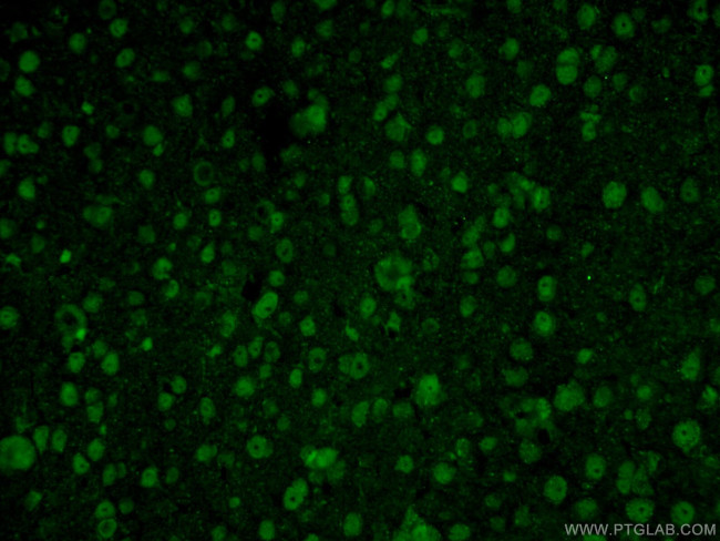 RCC1 Antibody in Immunohistochemistry (PFA fixed) (IHC (PFA))