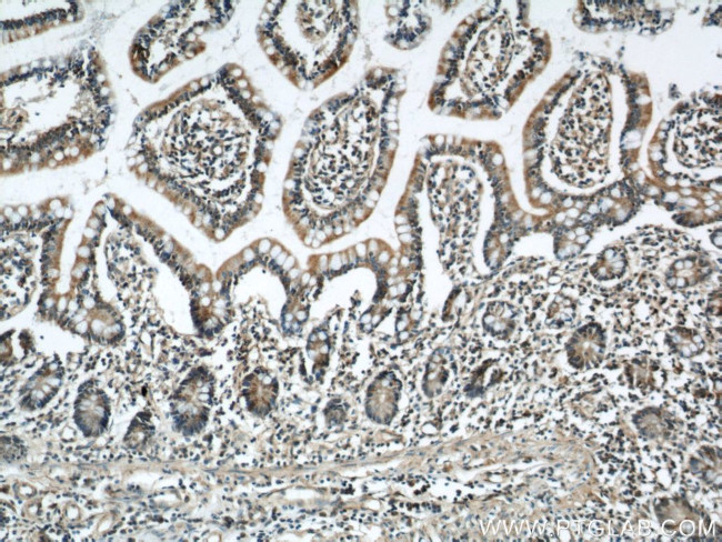 RCC1 Antibody in Immunohistochemistry (Paraffin) (IHC (P))