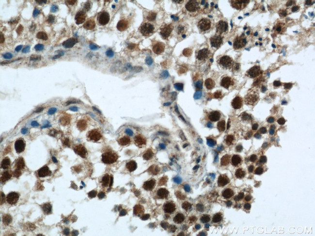 RCC1 Antibody in Immunohistochemistry (Paraffin) (IHC (P))