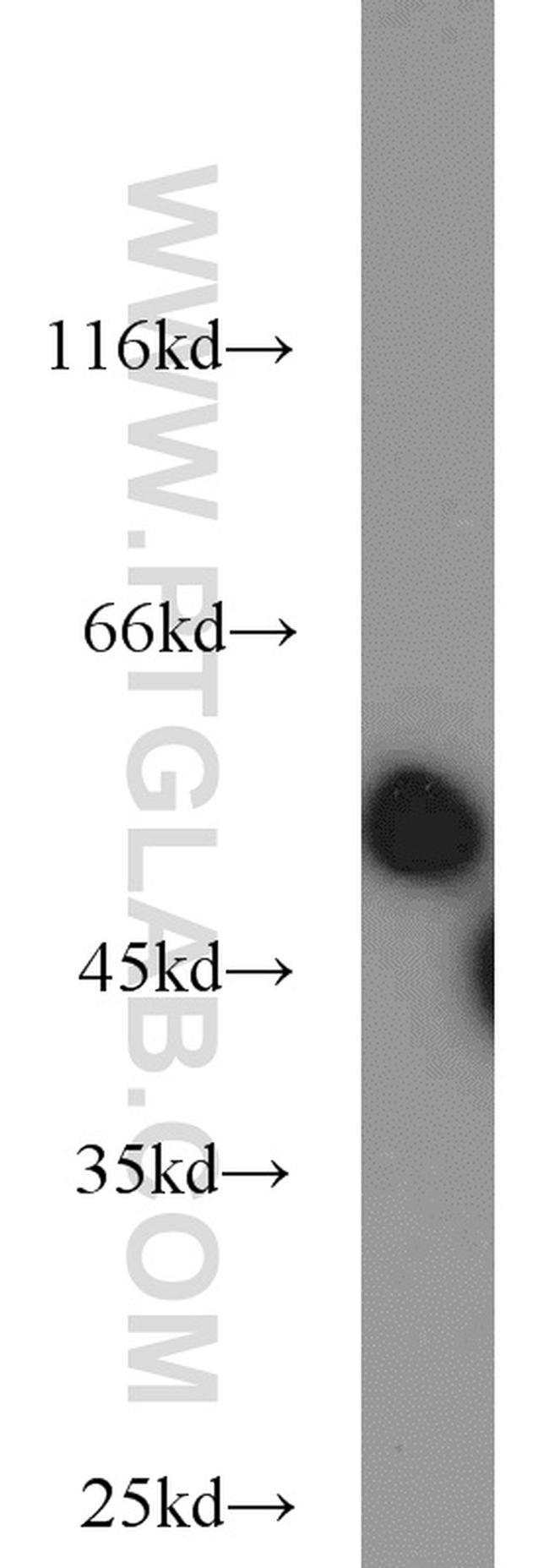 RCC1 Antibody in Western Blot (WB)