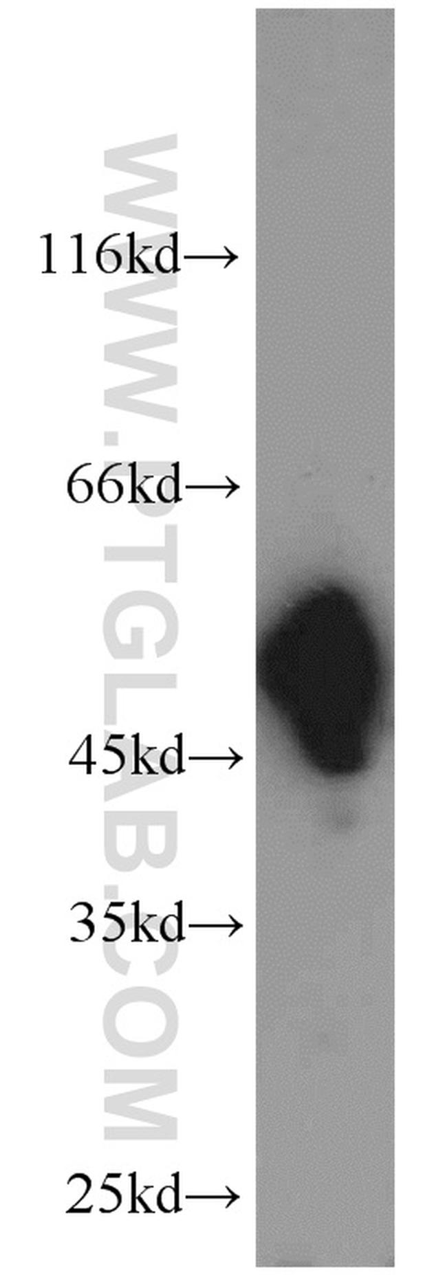 RCC1 Antibody in Western Blot (WB)