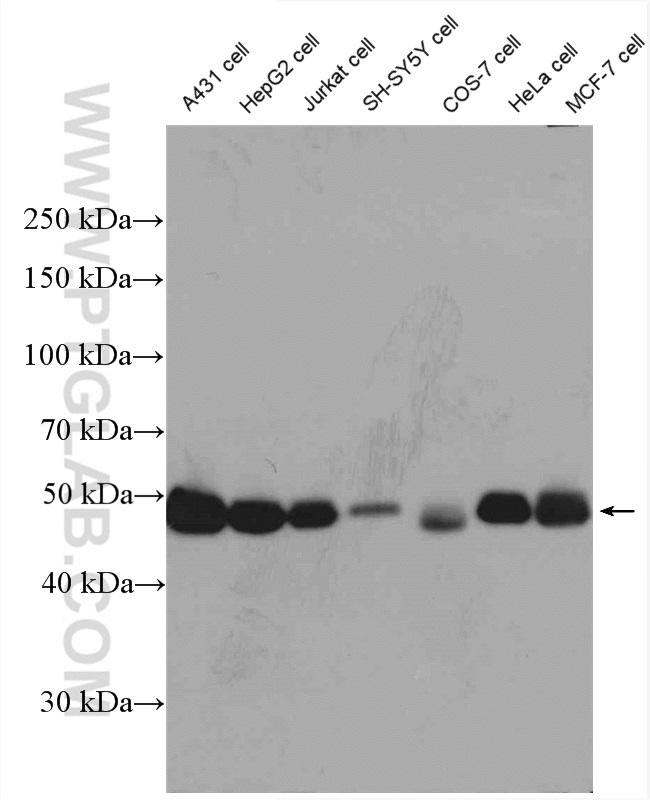 RCC1 Antibody in Western Blot (WB)