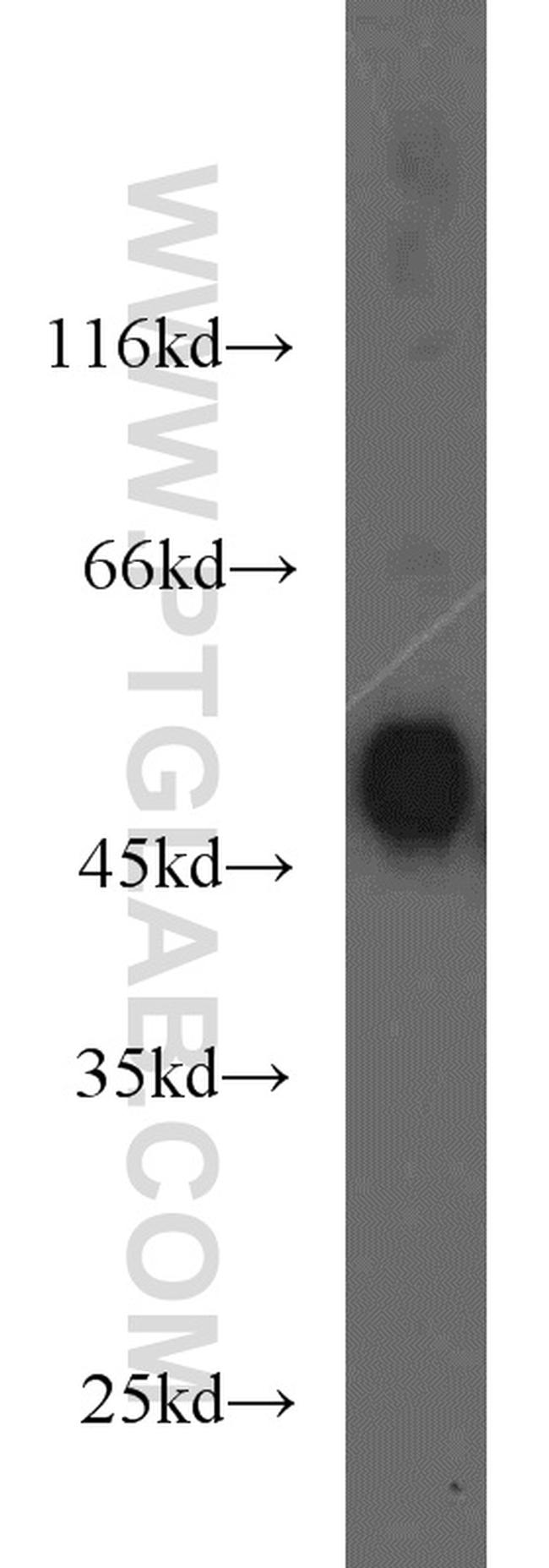 RCC1 Antibody in Western Blot (WB)