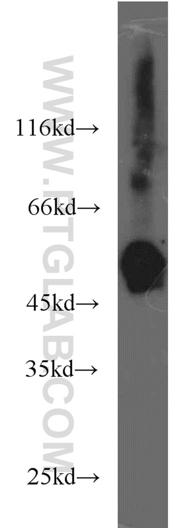 RCC1 Antibody in Western Blot (WB)