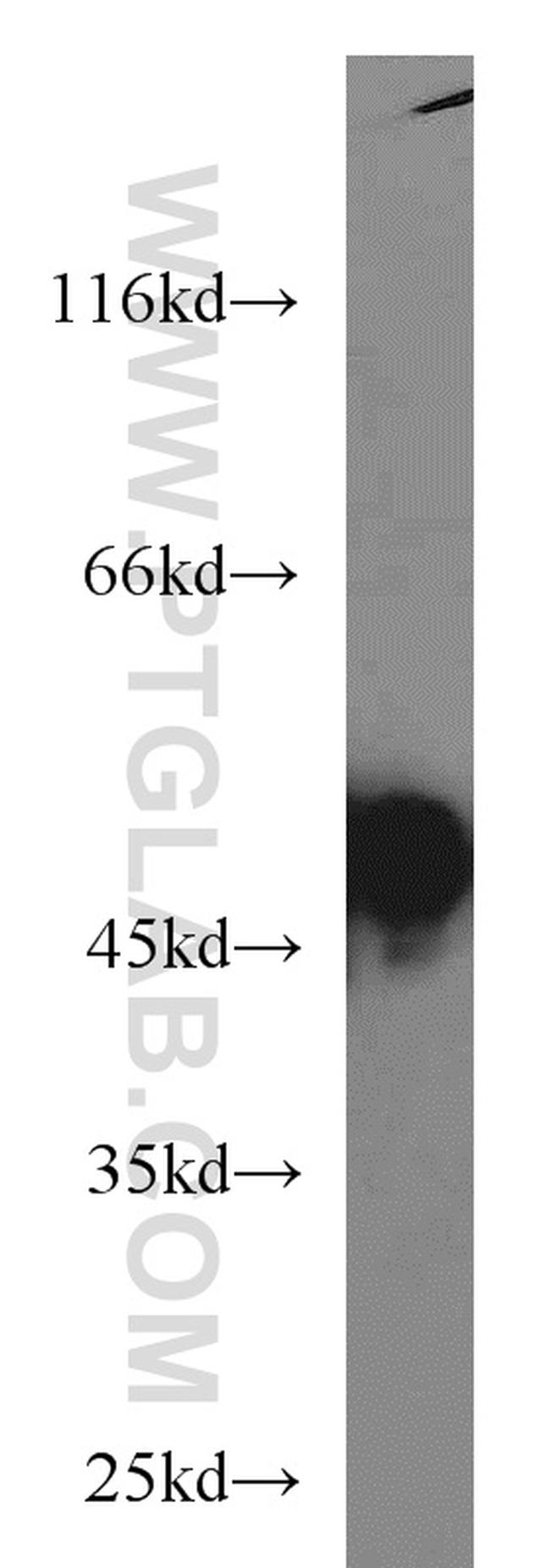 RCC1 Antibody in Western Blot (WB)