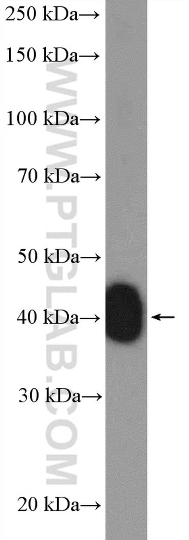 RCC1 Antibody in Western Blot (WB)