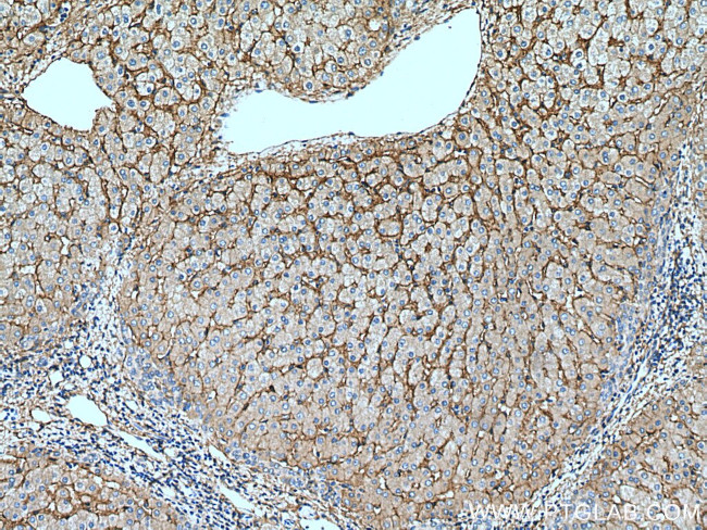 Integrin alpha-1 Antibody in Immunohistochemistry (Paraffin) (IHC (P))