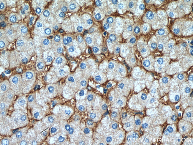 Integrin alpha-1 Antibody in Immunohistochemistry (Paraffin) (IHC (P))