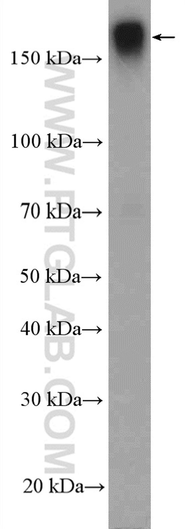 Integrin alpha-1 Antibody in Western Blot (WB)