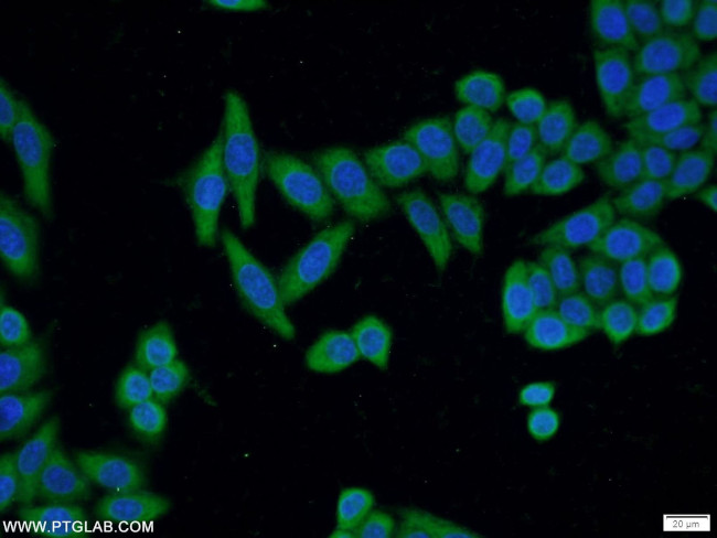 ADAM5 Antibody in Immunocytochemistry (ICC/IF)