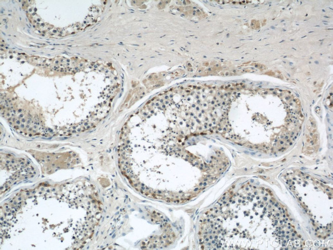 ADAM5 Antibody in Immunohistochemistry (Paraffin) (IHC (P))