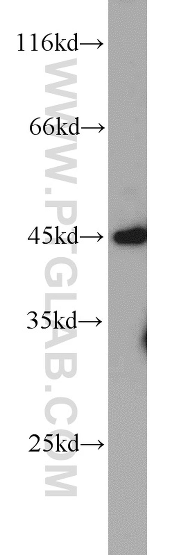 ADAM5 Antibody in Western Blot (WB)