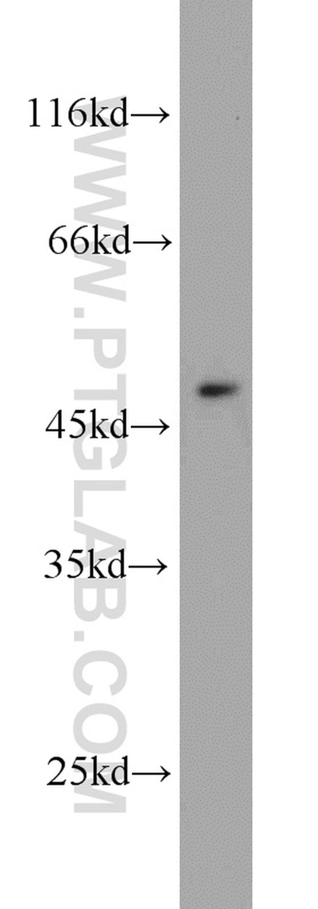 ADAM5 Antibody in Western Blot (WB)