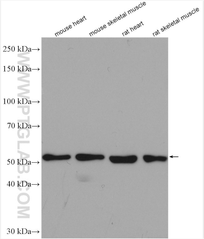 TRIM72 Antibody in Western Blot (WB)