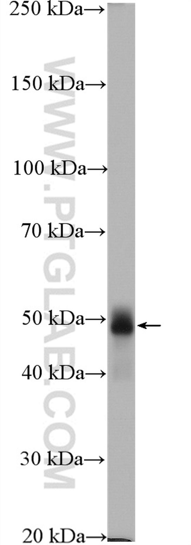 TRIM72 Antibody in Western Blot (WB)