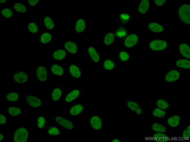 YY1 Antibody in Immunocytochemistry (ICC/IF)