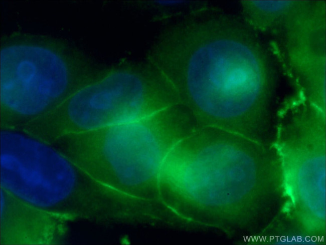 IQGAP1 Antibody in Immunocytochemistry (ICC/IF)