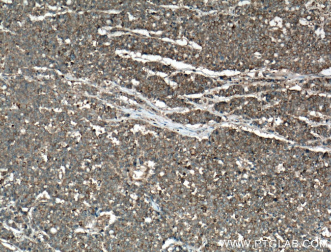 IQGAP1 Antibody in Immunohistochemistry (Paraffin) (IHC (P))