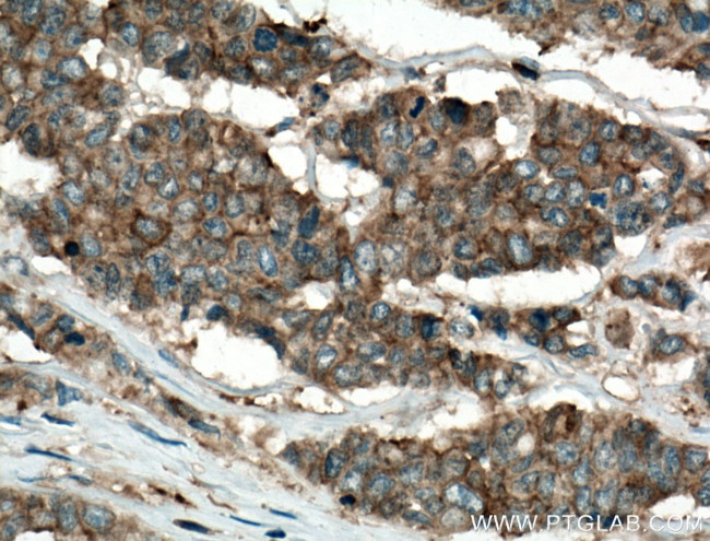 IQGAP1 Antibody in Immunohistochemistry (Paraffin) (IHC (P))