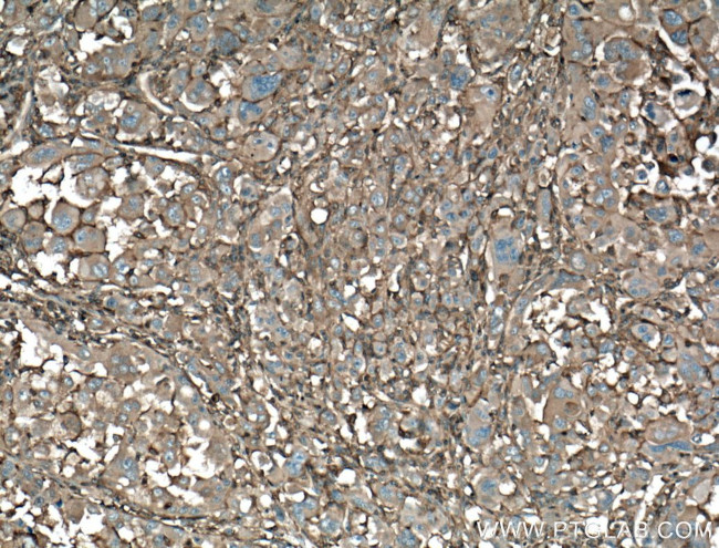 IQGAP1 Antibody in Immunohistochemistry (Paraffin) (IHC (P))