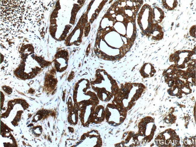 IQGAP1 Antibody in Immunohistochemistry (Paraffin) (IHC (P))