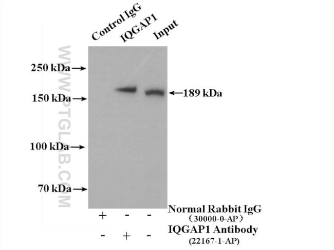 IQGAP1 Antibody in Immunoprecipitation (IP)