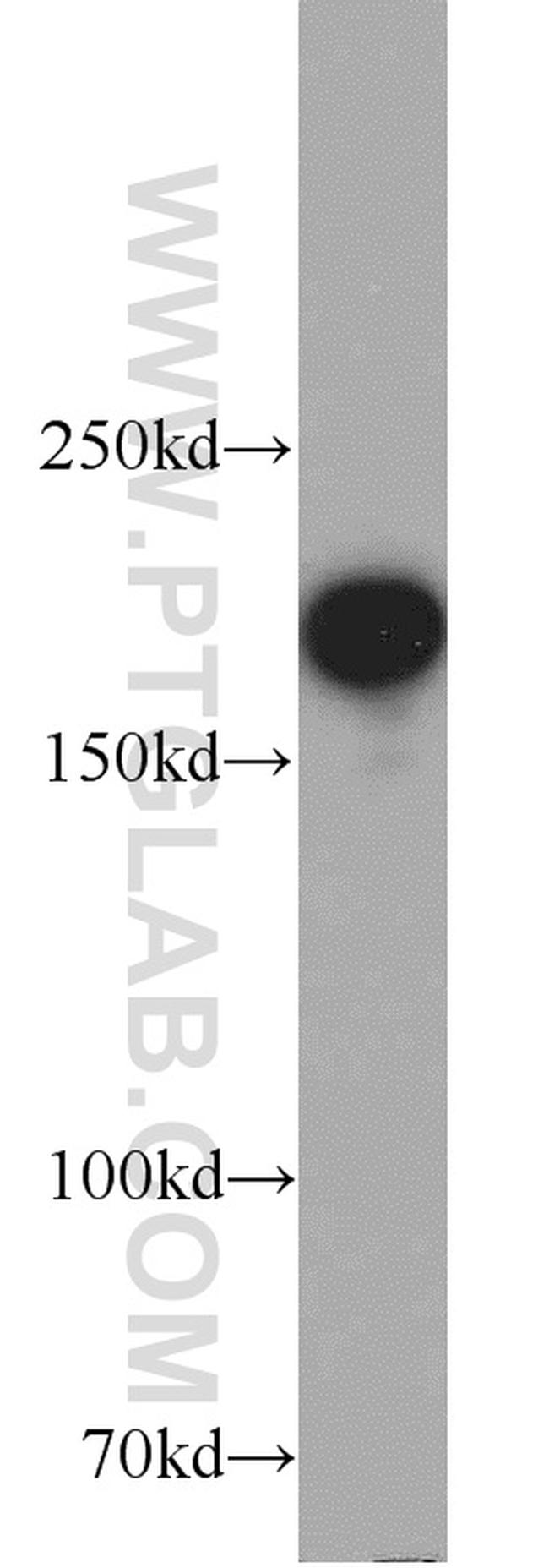 IQGAP1 Antibody in Western Blot (WB)